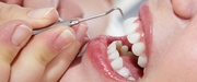 Looking for a Best Top Dental Clinic Brooklyn